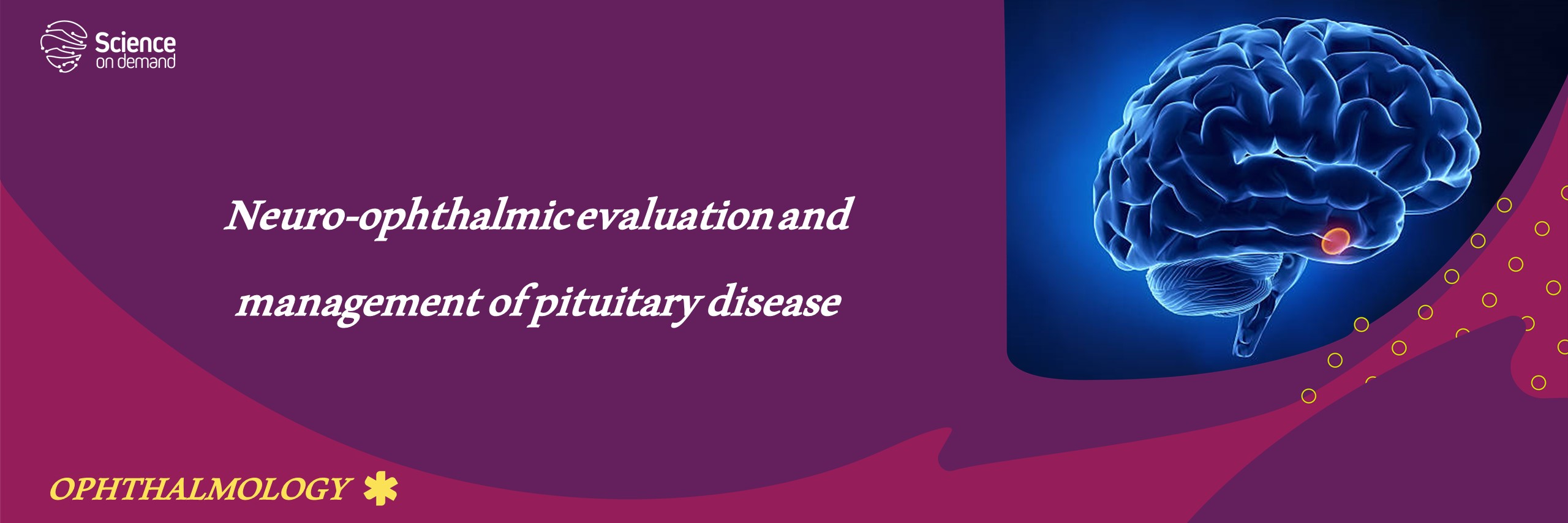 Neuro-ophthalmic evaluation and management of pituitary disease