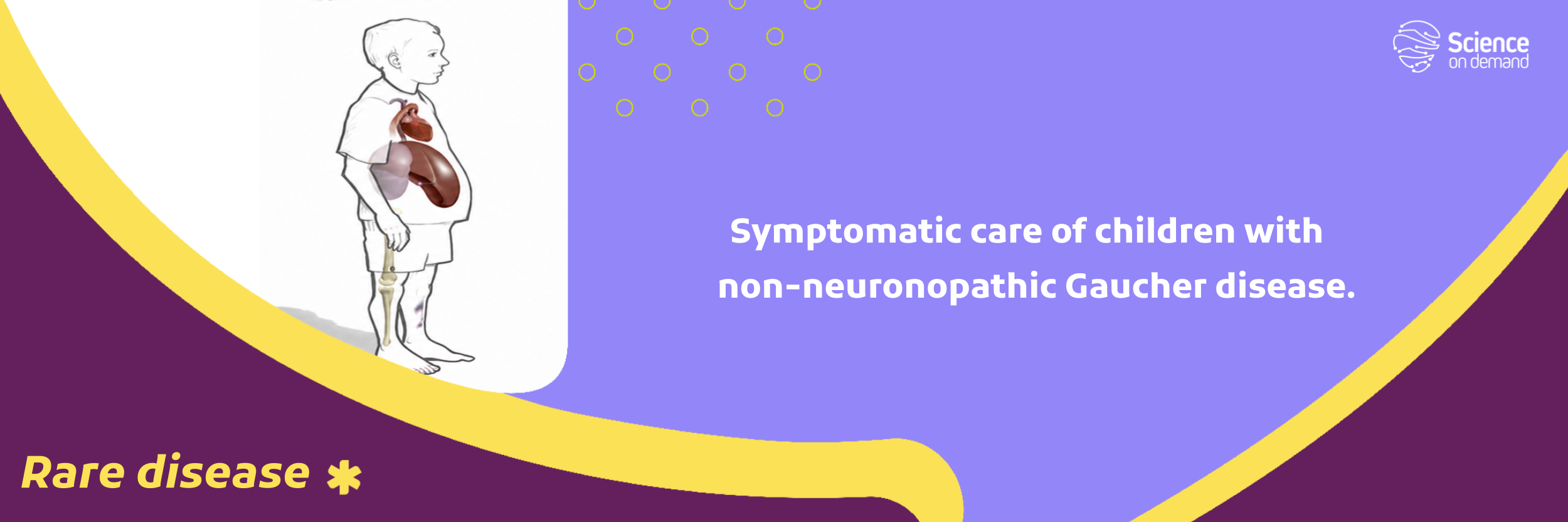 Symptomatic care of children with non-neuronopathic Gaucher disease.