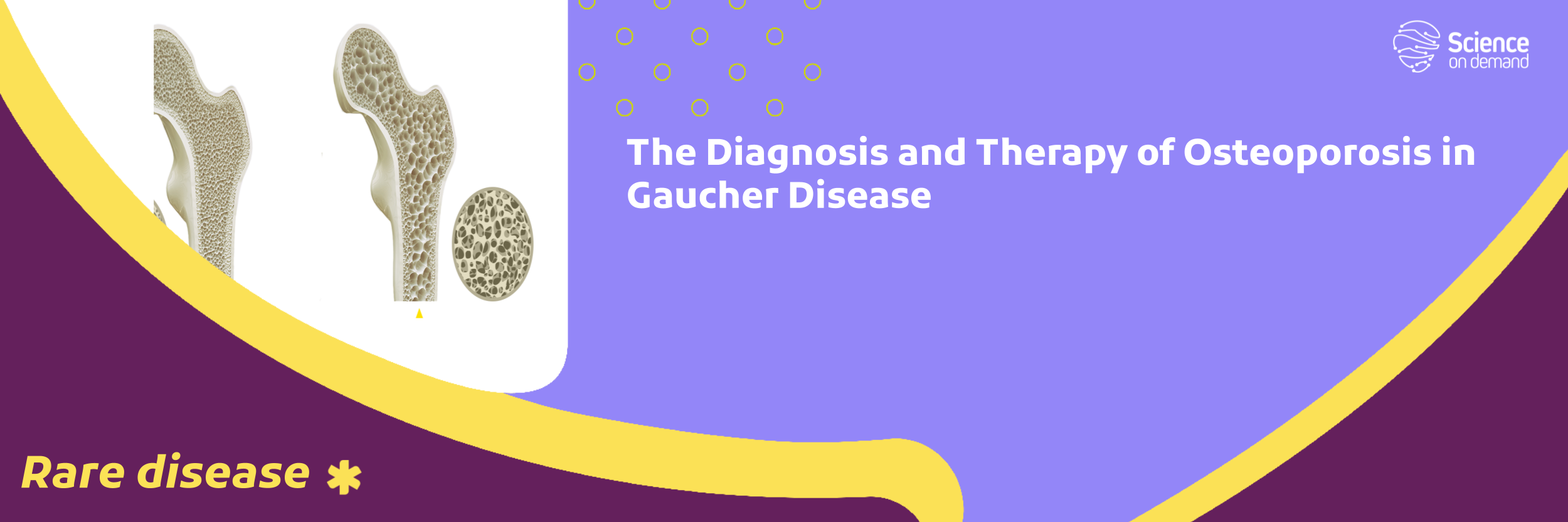 The Diagnosis and Therapy of Osteoporosis in Gaucher Disease